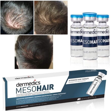  Kurz Mezoterapie Vlasov vrátane príslušenstva