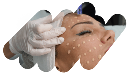 BB GLOW s Hydrapenom  + Kurz ošetrenia tváre + ZADARMO kurz účinných látok